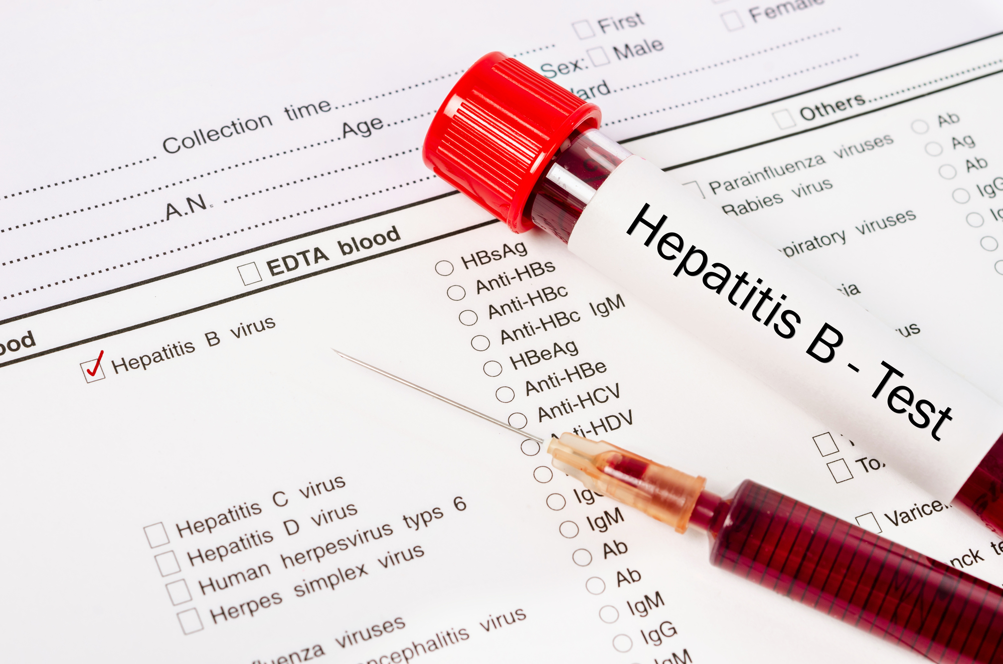 Ｂ型肝炎の検査